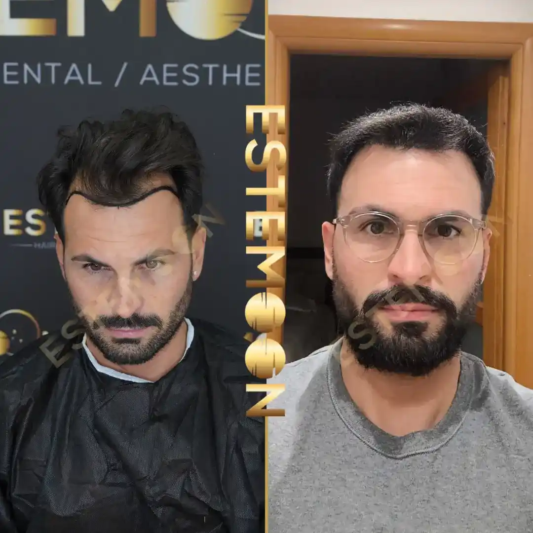 SERGIO
